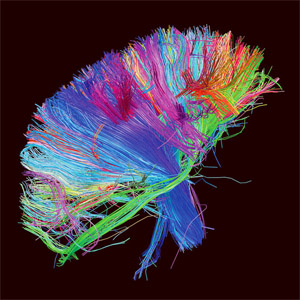 Disco The 2nd Law de Muse